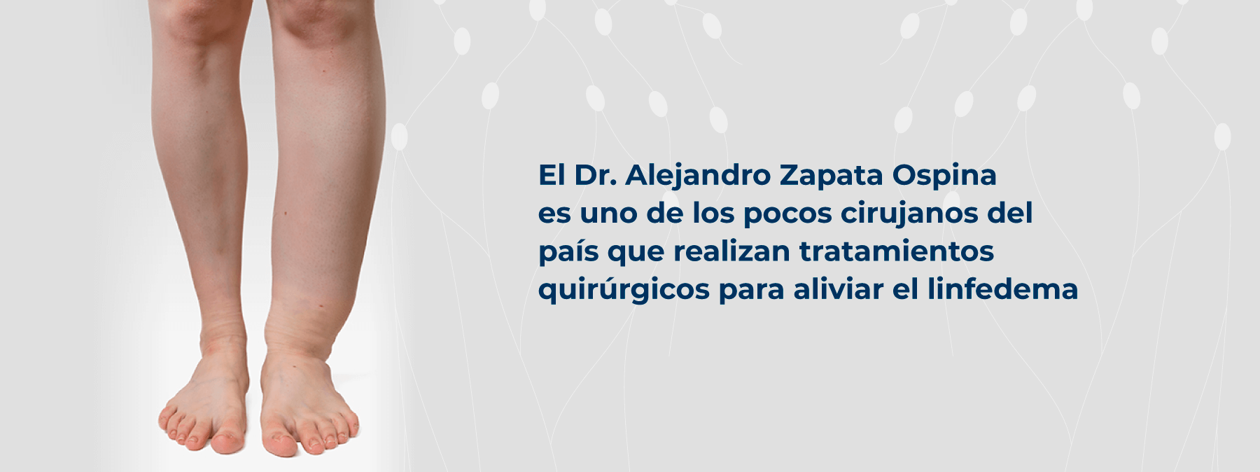 Cirujano Plástico Medellín | Microcirugía de linfedema |